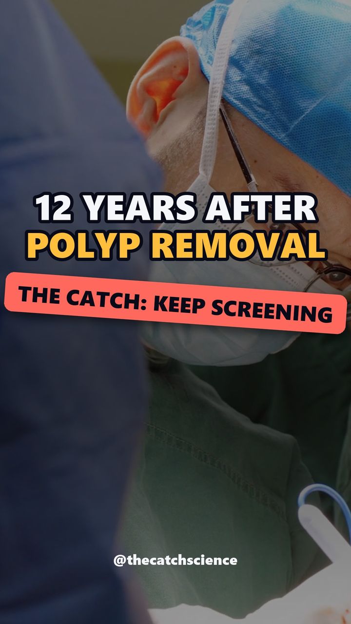 12 YEARS AFTER POLYP REMOVAL. The catch: Keep screening