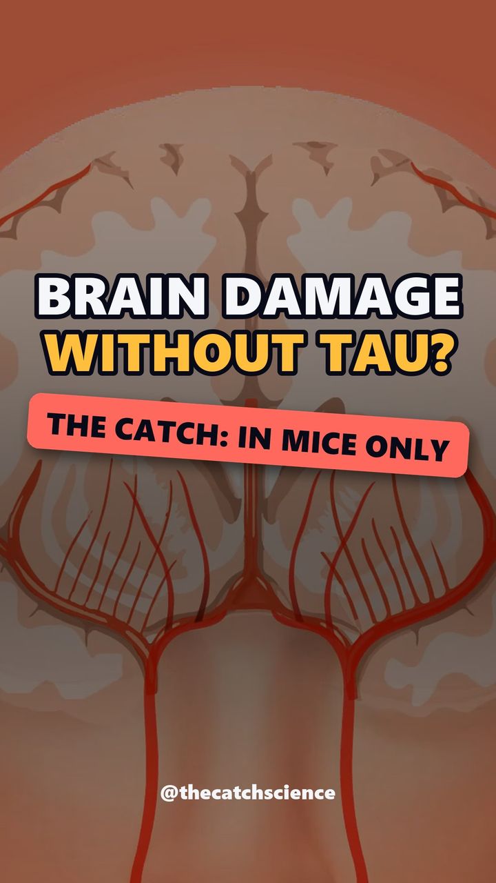 BRAIN DAMAGE WITHOUT TAU?. The catch: In mice only